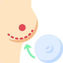 medical,healthcare and medical,arrow,body parts,implant,anatomy,surgery,human body,breast,silicone,bust,breast implant ok 